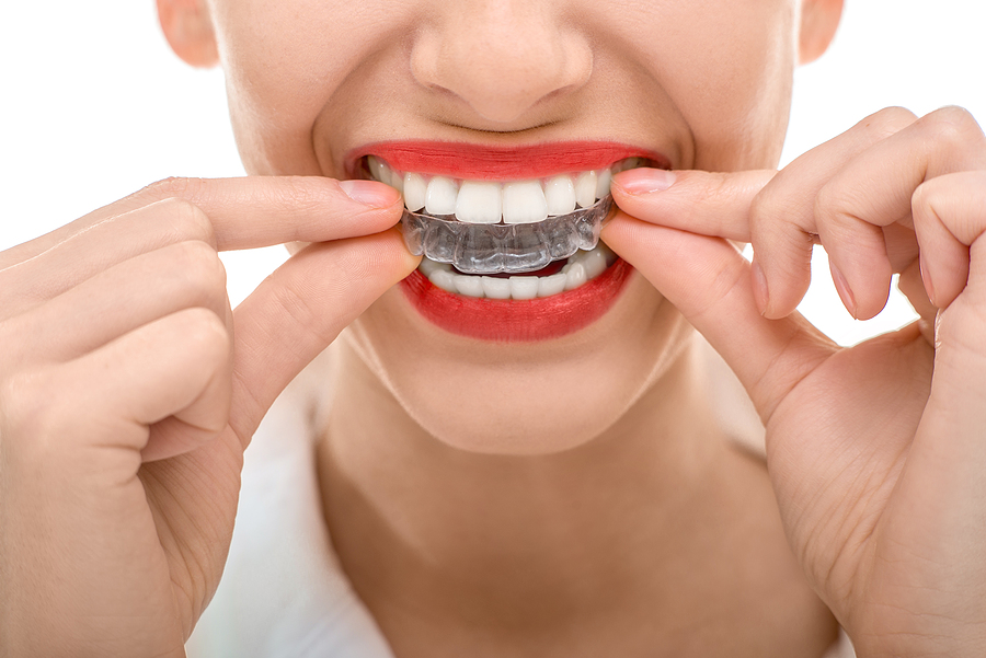 Achieving a Confident Smile: Comprehensive Guide to Orthodontics in Staten Island, NY