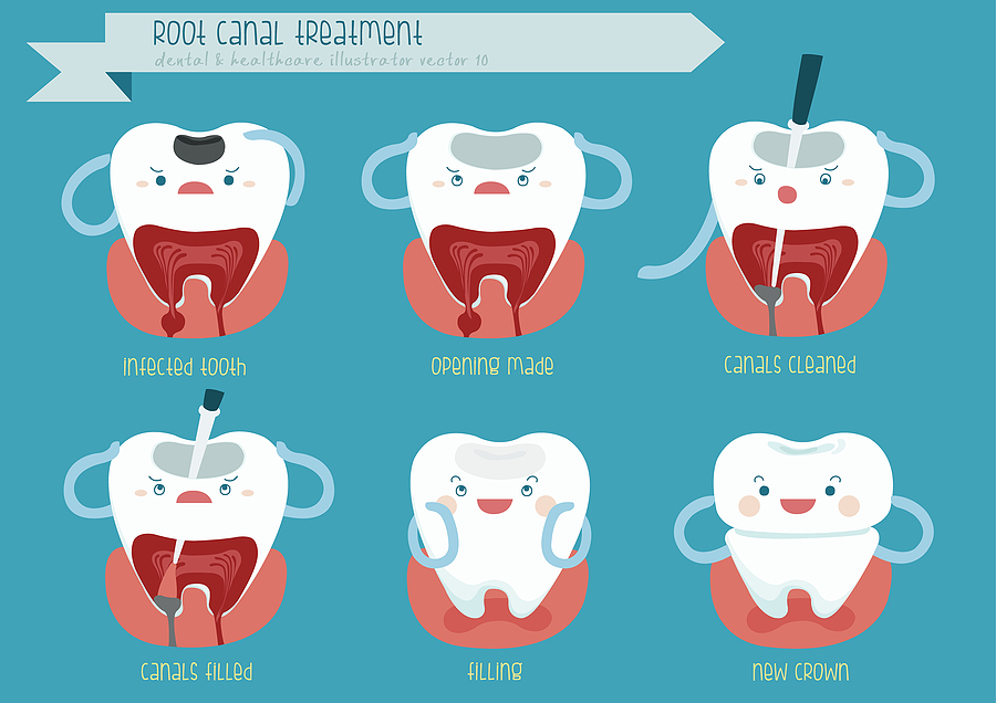 Understanding Root Canal Treatment: A Path to Saving Your Smile